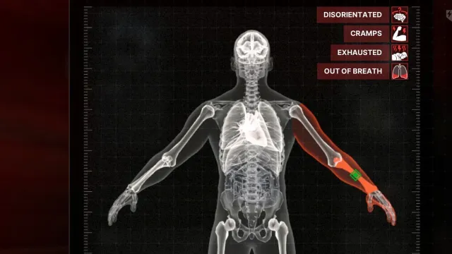 Gray Zone Warfare Wounds